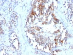 SHBG Antibody (SPM605), Novus Biologicals 0.2mg; Unlabeled:Antibodies,